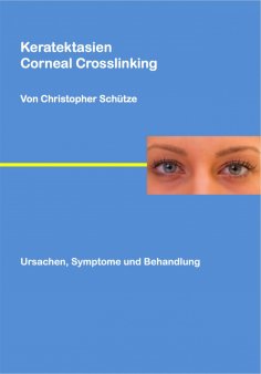 eBook: Keratektasien