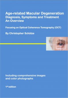 eBook: Age-related macular degeneration