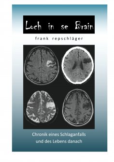 ebook: Loch in se Brain