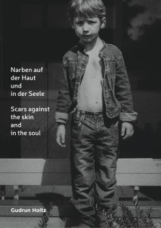 ebook: Narben auf der Haut und in der Seele