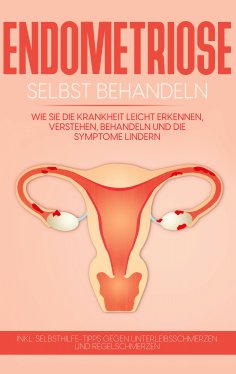 eBook: Endometriose selbst behandeln: Wie Sie die Krankheit leicht erkennen, verstehen, behandeln und die S