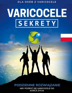 eBook: Varicocele