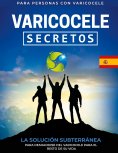 eBook: Varicocele