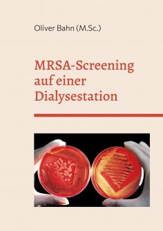 eBook: MRSA-Screening auf einer Dialysestation