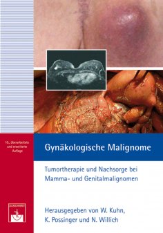 ebook: Gynäkologische Malignome