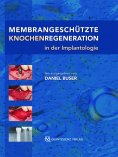 eBook: Membrangeschützte Knochenregeneration in der Implantologie