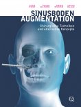 eBook: Sinusbodenaugmentation