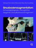 ebook: Sinusbodenaugmentation