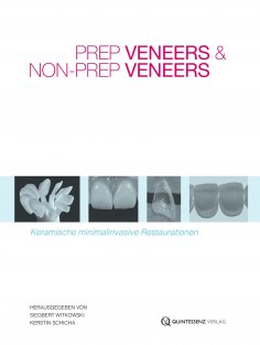 ebook: Prep Veneers und Non-Prep Veneers
