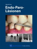 eBook: Endo-Paro-Läsionen