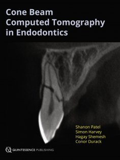 ebook: Cone Beam Computed Tomography in Endodontics