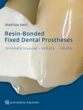 eBook: Resin-Bonded Fixed Dental Prostheses