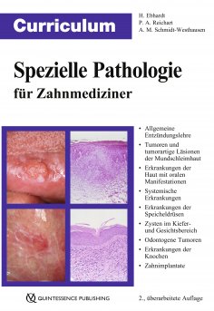 eBook: Curriculum Spezielle Pathologie für Zahnmediziner