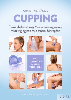 eBook: Cupping