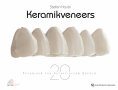 ebook: Keramikveneers