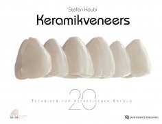 ebook: Keramikveneers