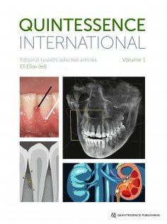 ebook: Quintessence International Volume 1