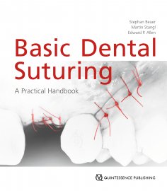 eBook: Basic Dental Suturing