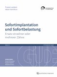 eBook: Sofortimplantation und Sofortbelastung