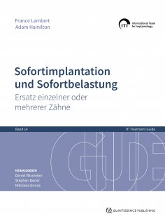 eBook: Sofortimplantation und Sofortbelastung