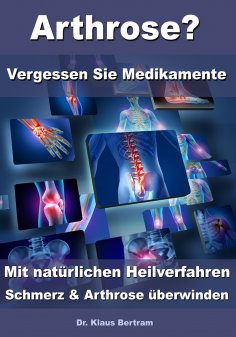 ebook: Arthrose? – Vergessen Sie Medikamente – Mit natürlichen Heilverfahren Schmerz & Arthrose überwinden