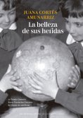 eBook: La belleza de sus heridas