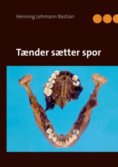 eBook: Tænder sætter spor